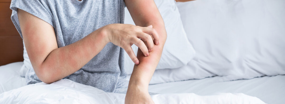La literie idéale pour les personnes allergiques